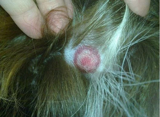 Le vrai scandale de la maladie de Lyme