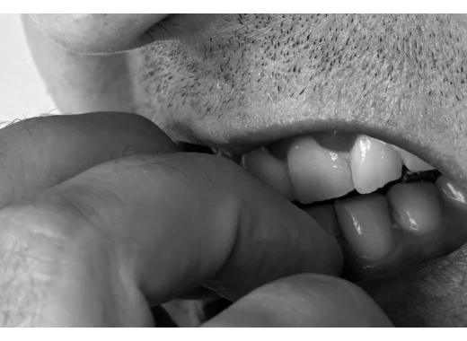 Se ronger les ongles : facteurs et traitements